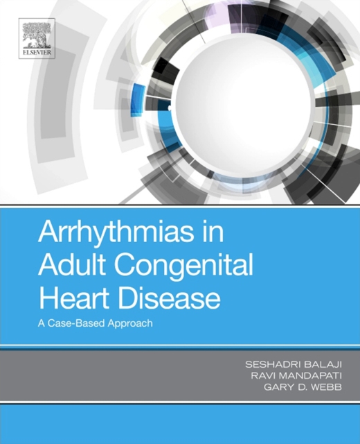 Arrhythmias in Adult Congenital Heart Disease : A Case-Based Approach, EPUB eBook