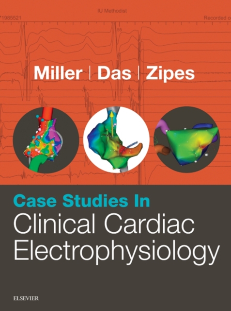 Case Studies in Clinical Cardiac Electrophysiology, EPUB eBook