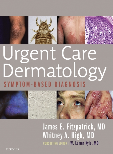 Urgent Care Dermatology: Symptom-Based Diagnosis E-Book : Urgent Care Dermatology: Symptom-Based Diagnosis E-Book, EPUB eBook