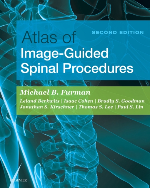Atlas of Image-Guided Spinal Procedures E-Book : Atlas of Image-Guided Spinal Procedures E-Book, EPUB eBook