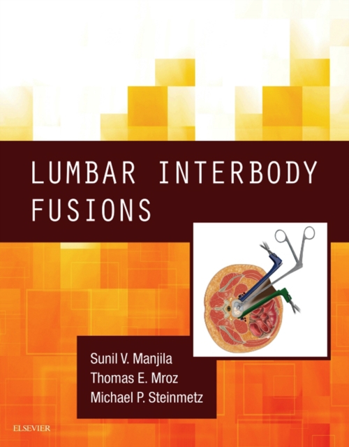 Lumbar Interbody Fusions E-Book, EPUB eBook