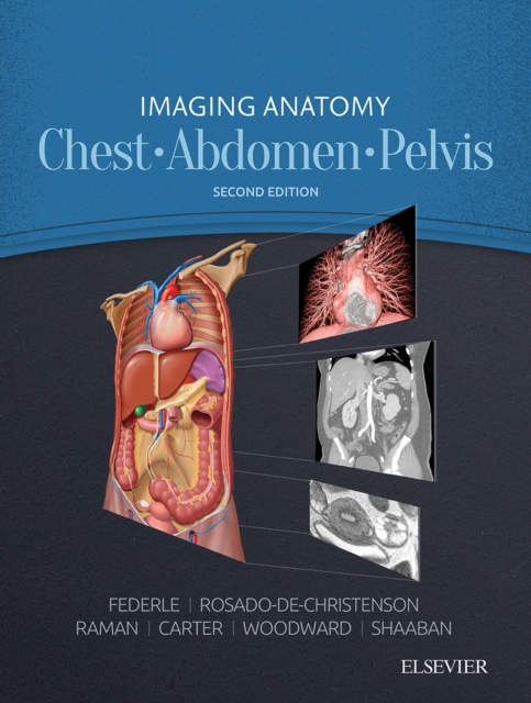 Imaging Anatomy: Chest, Abdomen, Pelvis E-Book, EPUB eBook