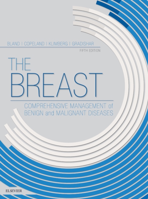 The Breast E-Book : Comprehensive Management of Benign and Malignant Diseases, EPUB eBook