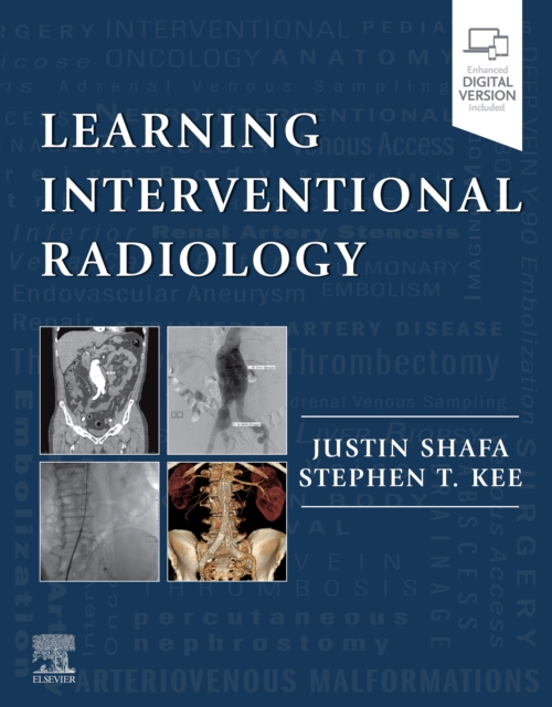 Learning Interventional Radiology : Learning Interventional Radiology eBook, EPUB eBook