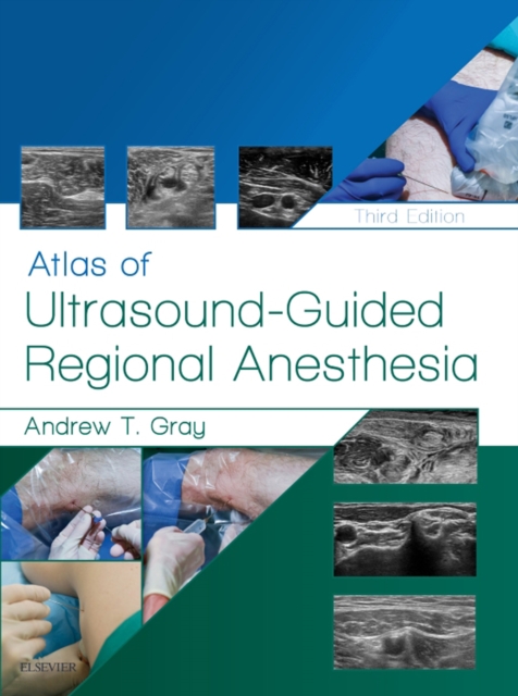 Atlas of Ultrasound-Guided Regional Anesthesia E-Book, EPUB eBook