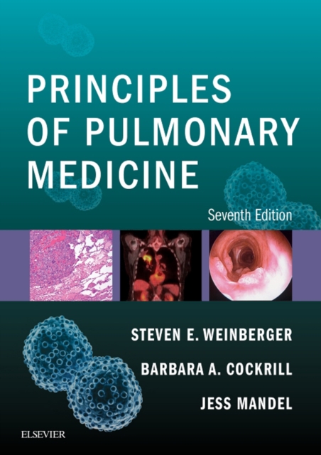 Principles of Pulmonary Medicine E-Book, EPUB eBook