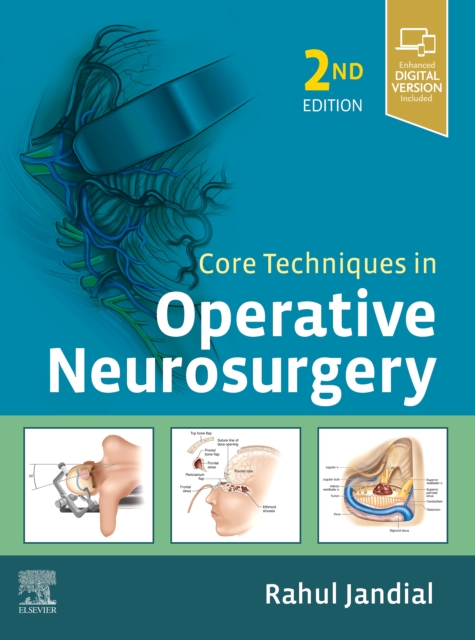 Core Techniques in Operative Neurosurgery, EPUB eBook