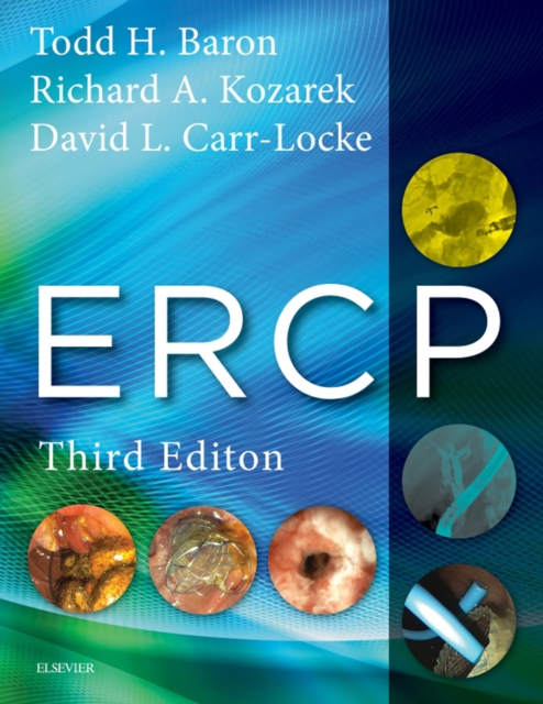 ERCP E-Book, EPUB eBook