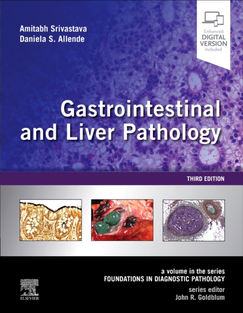 Gastrointestinal and Liver Pathology : A Volume in the Series: Foundations in Diagnostic Pathology, Hardback Book