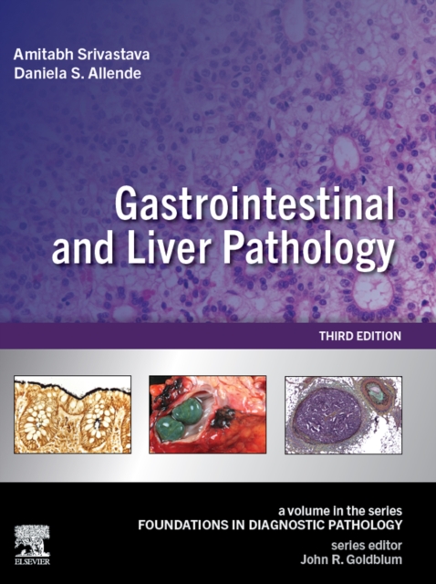 Gastrointestinal and Liver Pathology : A Volume in the Series: Foundations in Diagnostic Pathology, EPUB eBook
