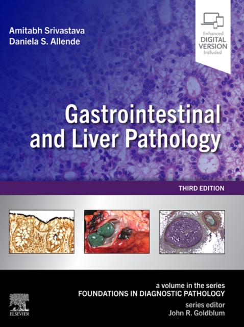 Gastrointestinal and Liver Pathology : A Volume in the Series: Foundations in Diagnostic Pathology, EPUB eBook