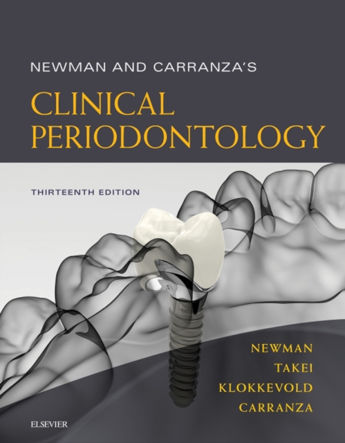 Newman and Carranza's Clinical Periodontology : Newman and Carranza's Clinical Periodontology E-Book, EPUB eBook