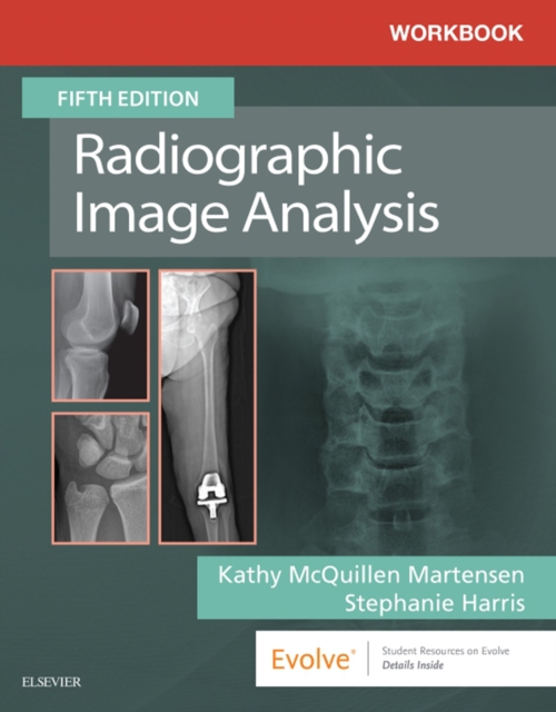 Workbook for Radiographic Image Analysis E-Book : Workbook for Radiographic Image Analysis E-Book, EPUB eBook