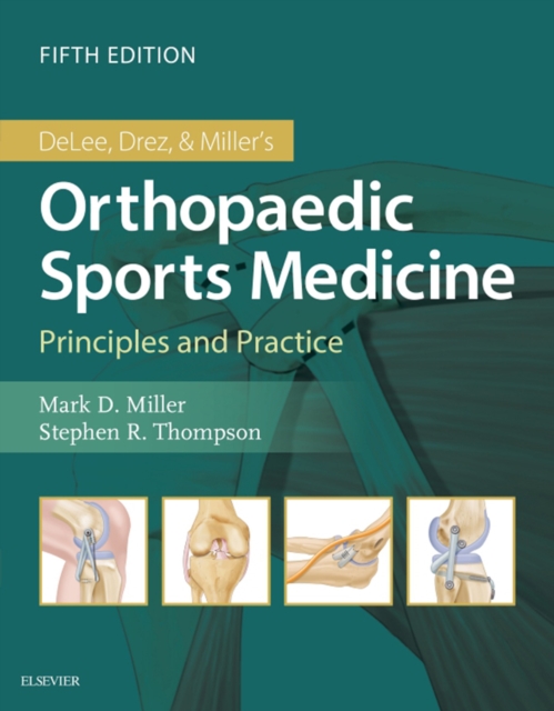 DeLee & Drez's Orthopaedic Sports Medicine E-Book : 2-Volume Set, EPUB eBook