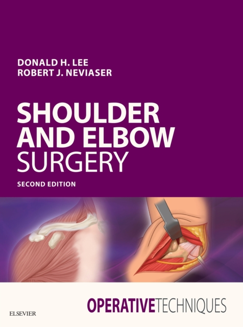 Operative Techniques: Shoulder and Elbow Surgery E-Book, PDF eBook