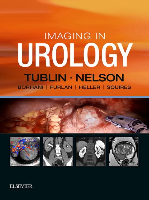 Imaging in Urology E-Book : Imaging in Urology E-Book, EPUB eBook