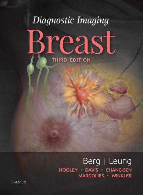 Diagnostic Imaging: Breast E-Book : Diagnostic Imaging: Breast E-Book, EPUB eBook