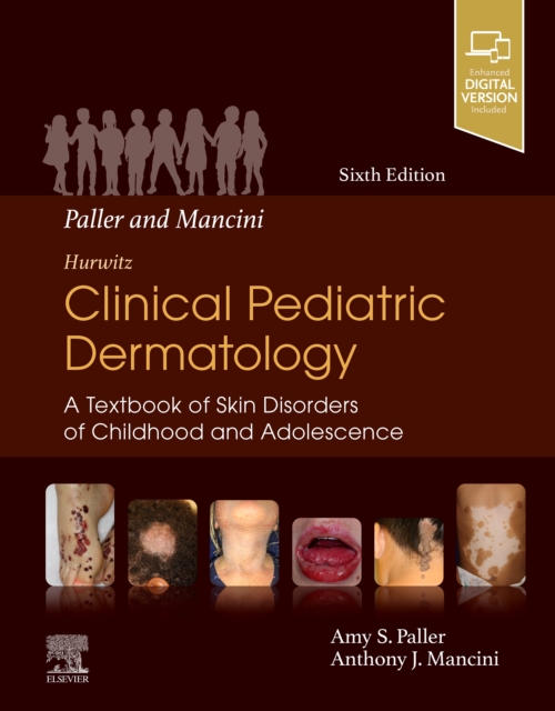 Paller and Mancini - Hurwitz Clinical Pediatric Dermatology E-Book : A Textbook of Skin Disorders of Childhood and Adolescence, PDF eBook