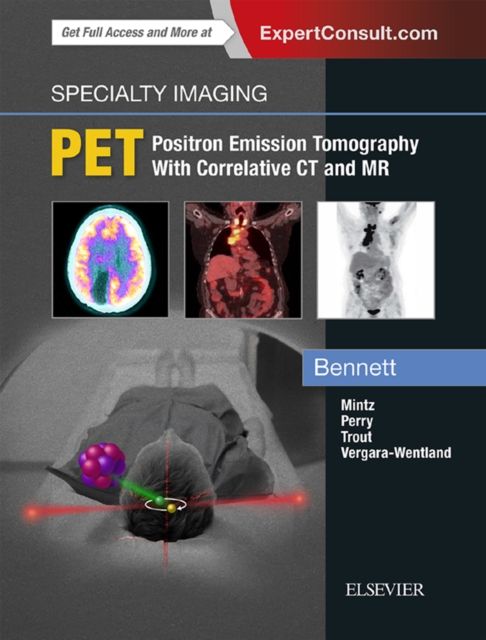 Specialty Imaging: PET - E-Book : Specialty Imaging: PET - E-Book, EPUB eBook