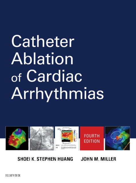 Catheter Ablation of Cardiac Arrhythmias E-Book : Catheter Ablation of Cardiac Arrhythmias E-Book, EPUB eBook