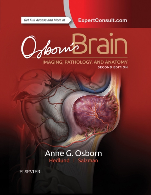 Osborn's Brain : Osborn's Brain E-Book, PDF eBook