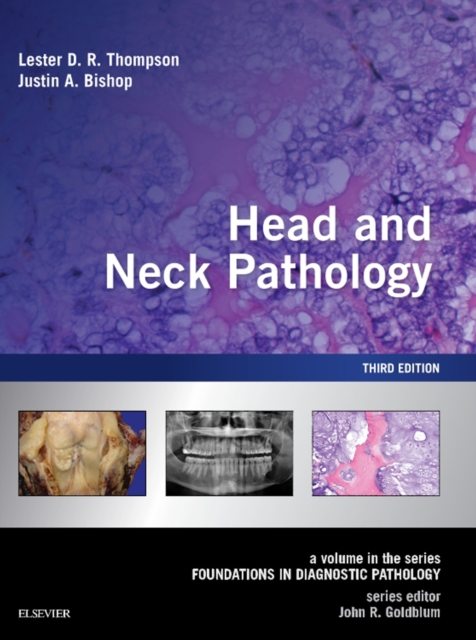 Head and Neck Pathology E-Book : A Volume in the Series: Foundations in Diagnostic Pathology, EPUB eBook