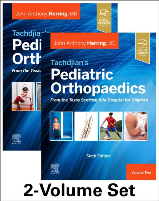 Tachdjian's Pediatric Orthopaedics: From the Texas Scottish Rite Hospital for Children, 6th edition : 2-Volume Set, Mixed media product Book