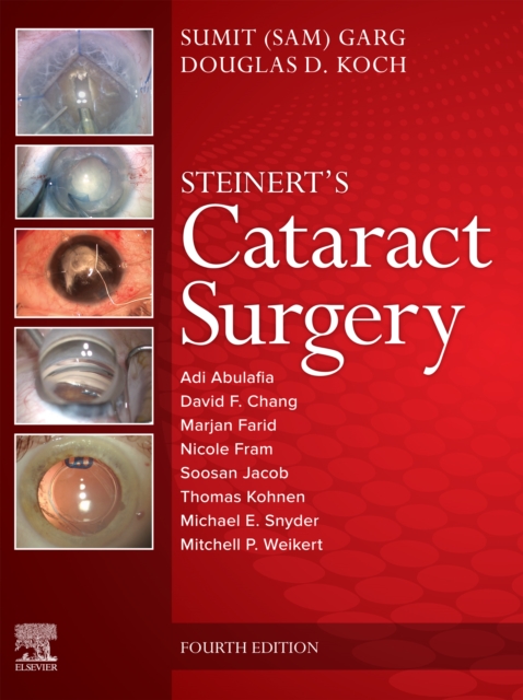Cataract Surgery, EPUB eBook