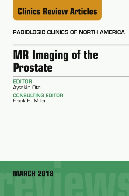 MR Imaging of the Prostate, An Issue of Radiologic Clinics of North America, EPUB eBook