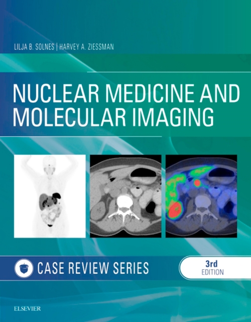 Nuclear Medicine and Molecular Imaging: Case Review Series E-Book : Nuclear Medicine and Molecular Imaging: Case Review Series E-Book, EPUB eBook