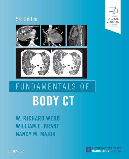 Fundamentals of Body CT, Paperback / softback Book