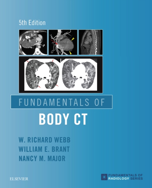 Fundamentals of Body CT E-Book, EPUB eBook