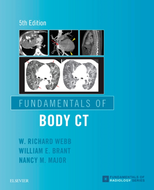 Fundamentals of Body CT E-Book, EPUB eBook