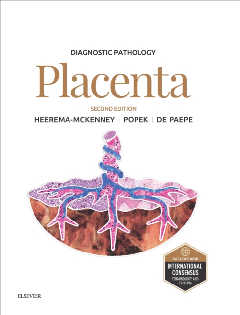Diagnostic Pathology: Placenta E-Book : Diagnostic Pathology: Placenta E-Book, EPUB eBook