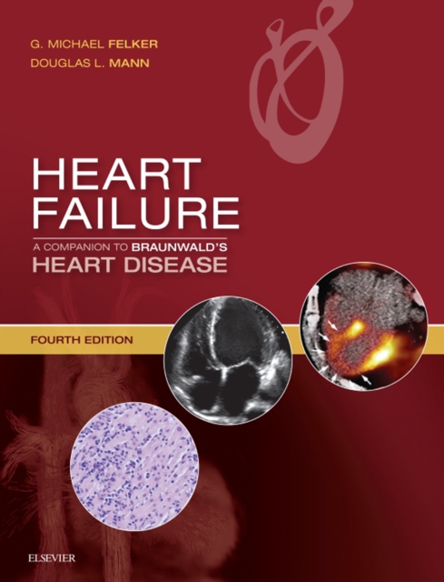 Heart Failure: A Companion to Braunwald's Heart Disease E-Book, EPUB eBook