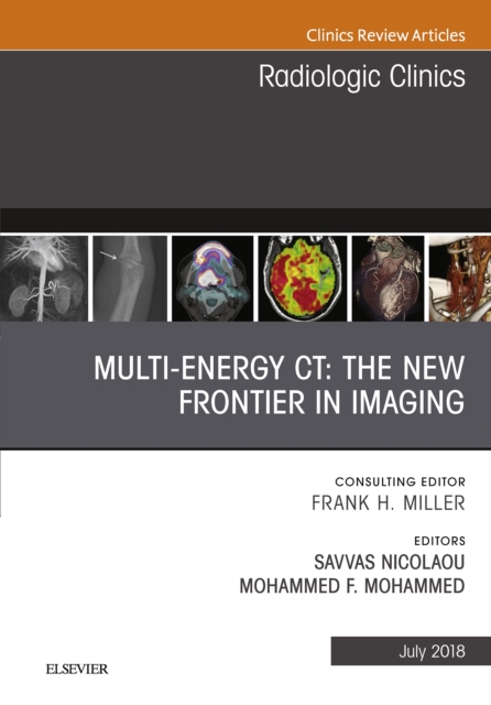 Multi-Energy CT: The New Frontier in Imaging, An Issue of Radiologic Clinics of North America, EPUB eBook