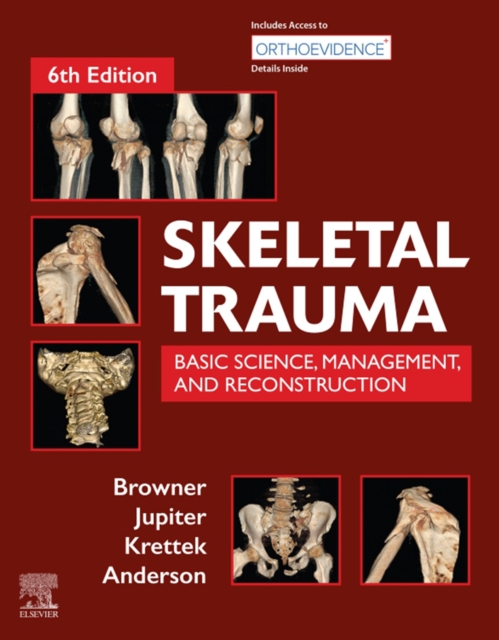 Skeletal Trauma : Basic Science, Management, and Reconstruction. 2 Vol Set, EPUB eBook