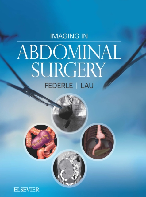 Imaging in Abdominal Surgery E-Book : Imaging in Abdominal Surgery E-Book, EPUB eBook