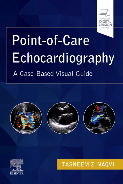 Point-of-Care Echocardiography : A Clinical Case-Based Visual Guide, Paperback / softback Book