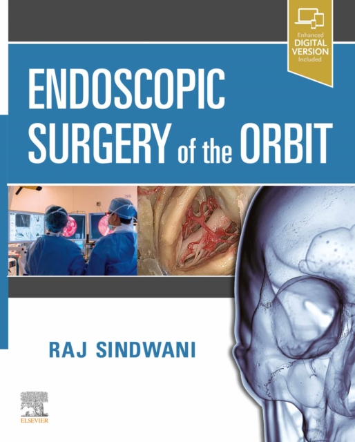 Endoscopic Surgery of the Orbit, EPUB eBook