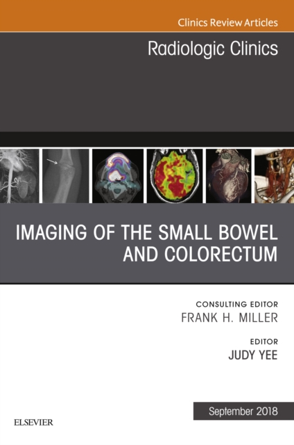 Imaging of the Small Bowel and Colorectum, An Issue of Radiologic Clinics of North America, EPUB eBook