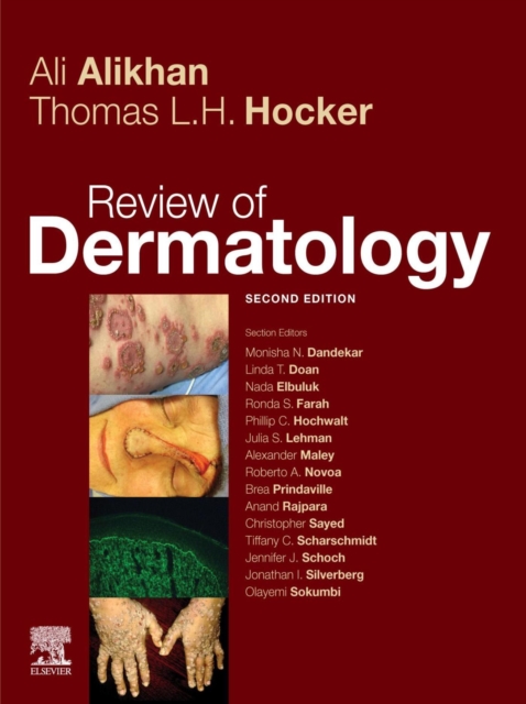 Review of Dermatology E-Book, EPUB eBook