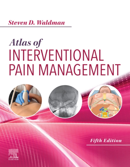 Atlas of Interventional Pain Management E-Book : Atlas of Interventional Pain Management E-Book, EPUB eBook