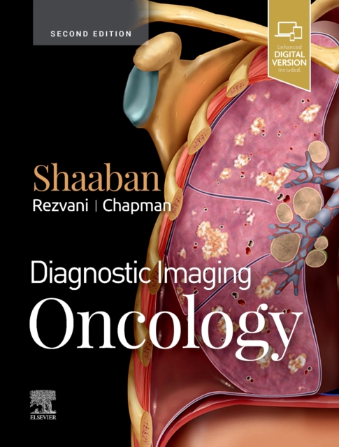 Diagnostic Imaging: Oncology, Hardback Book
