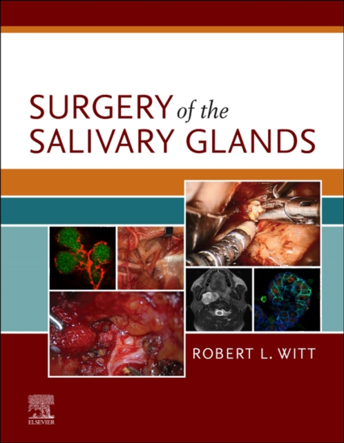 Surgery of the Salivary Glands E-Book, EPUB eBook
