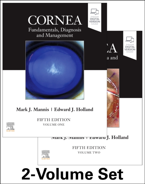 Cornea, 2-Volume Set, Multiple-component retail product Book