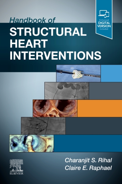 Handbook of Structural Heart Interventions, Paperback / softback Book