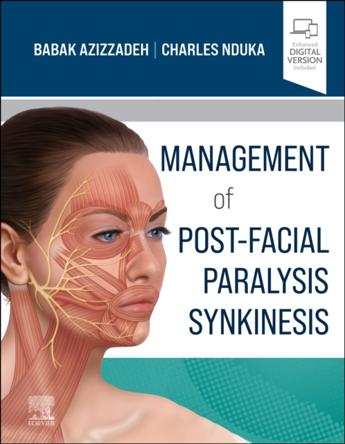 Management of Post-Facial Paralysis Synkinesis, Hardback Book