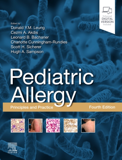 Pediatric Allergy,E-Book : Principles and Practice, PDF eBook
