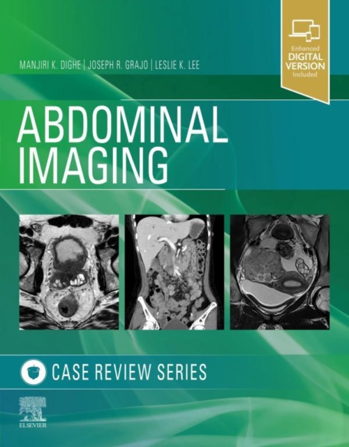 Abdominal Imaging : Case Review Series, EPUB eBook